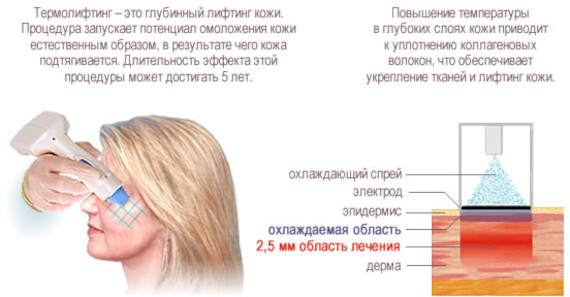 Круглое лицо у девушки. Как исправить, вытянуть, убрать щеки